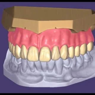 Profile image of exocad-3shape-cerec expert on Telegram